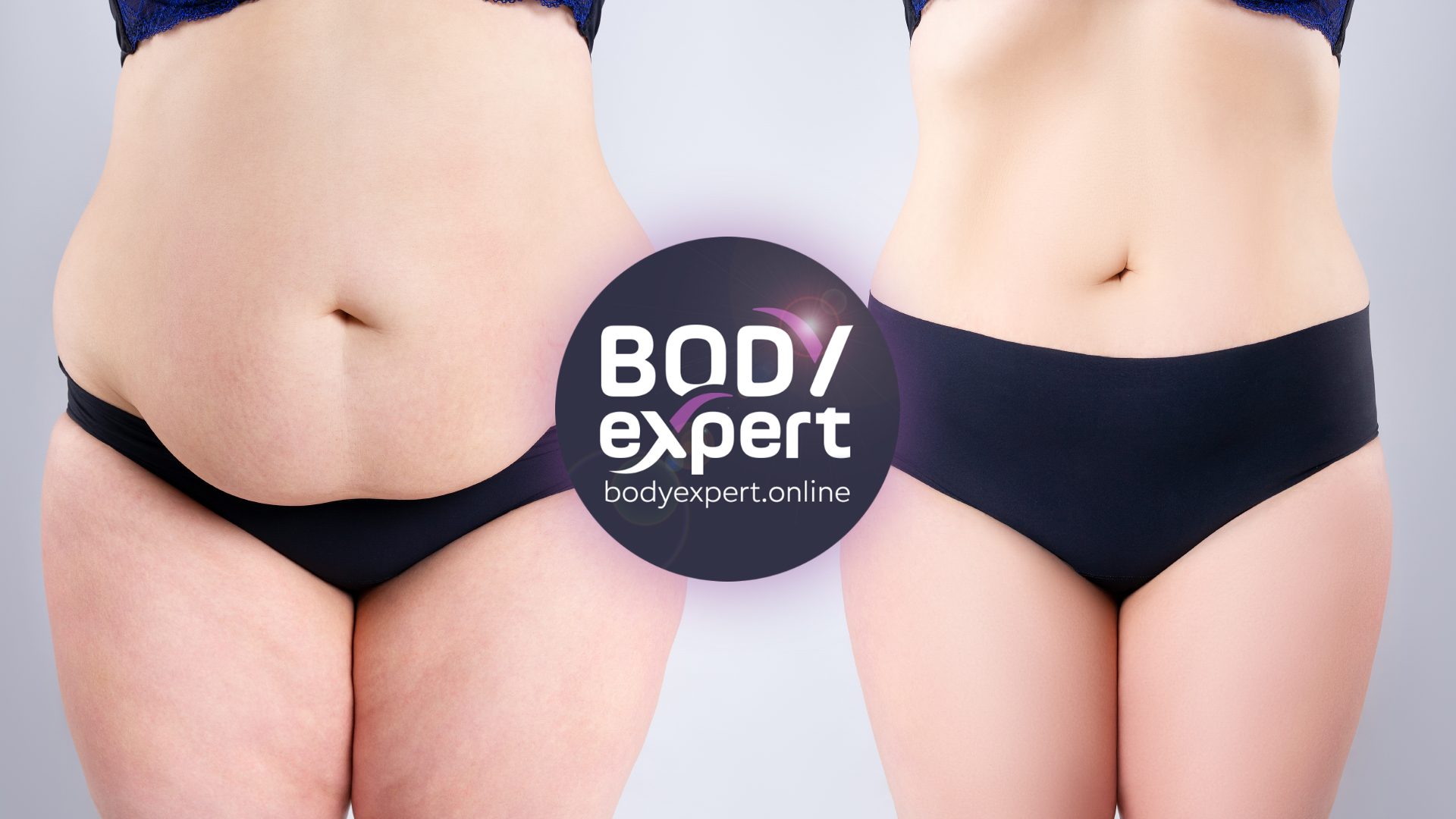 Belly and thick liposuction : the results before and after