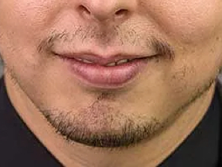 image-absence-moustache