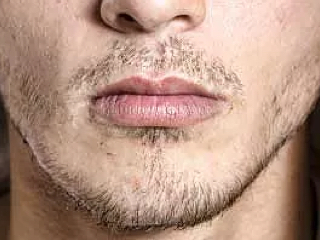 image-barbe-clairsemée