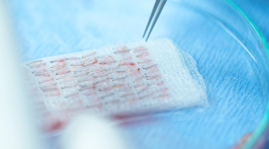 image-controle-transparence-greffe-cheveux