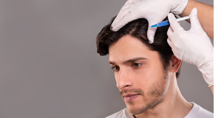 image-implantation-follicules