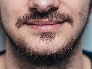 image-mauvaise-forme-barbe