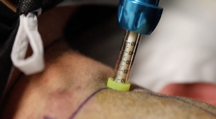 image-zone-prelevement