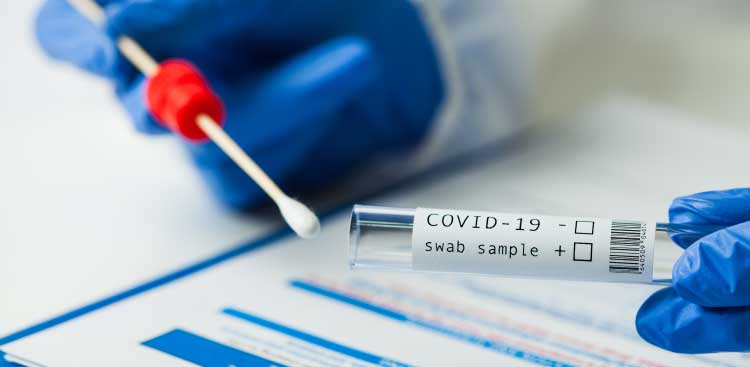 Covid 19 en Turquie : Notre protocole PCR pour votre retour sans soucis