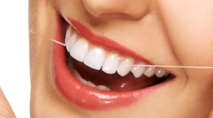 image-entretien-facettes-dentaires