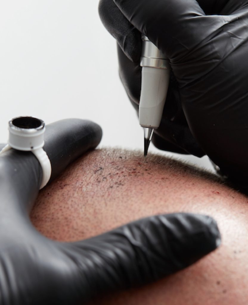 image-expert-micropigmentation-Turquie