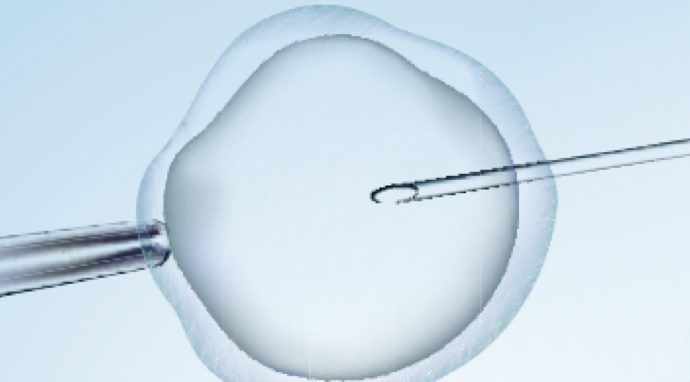image-injection-intracytoplamique-de-spermatozoïde