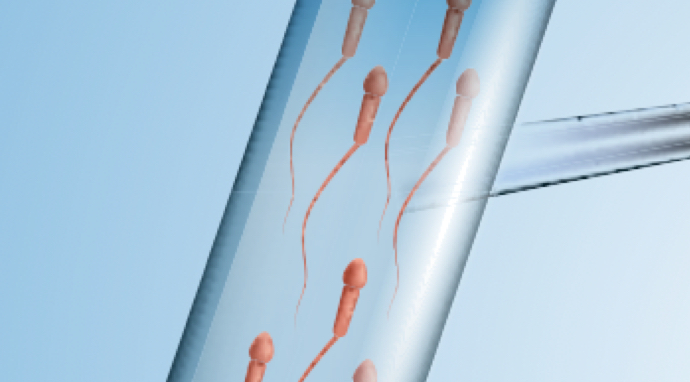 image-injection-magnifiée-de-spermatozoïde