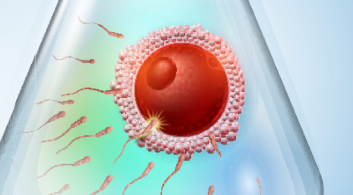 image-insemination-intra-uterine