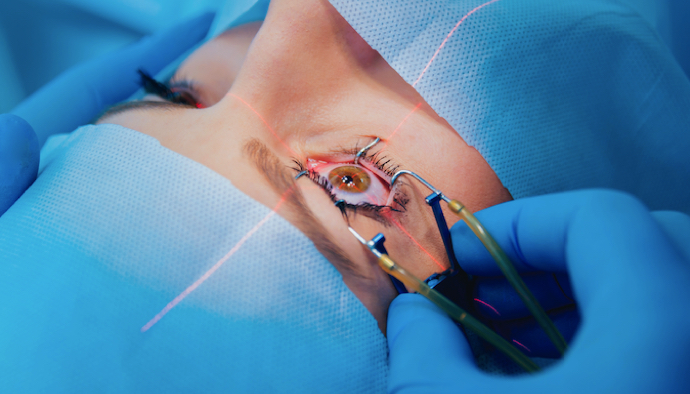 image-laser-oculaire