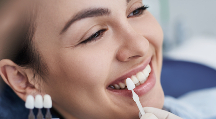 image-prix-facette-dentaire