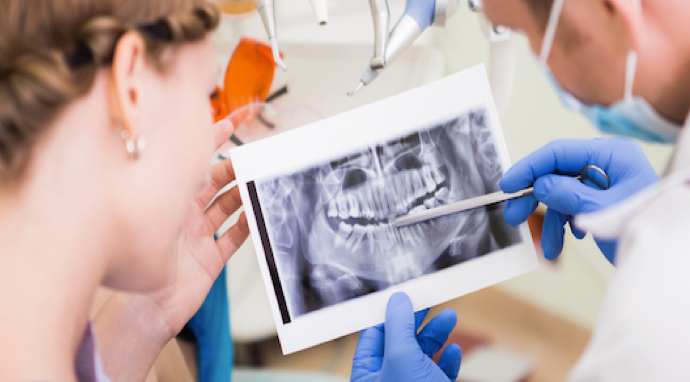 image-remboursement-implant-dentaire