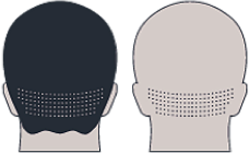 image-reparation-zone-FUE