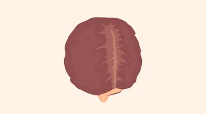 image-stage-ludwig-1