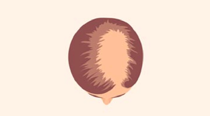 image-stage-ludwig-3