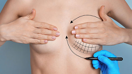 4 Ways to Get Fuller, Lifted Breasts, Orange County, CA