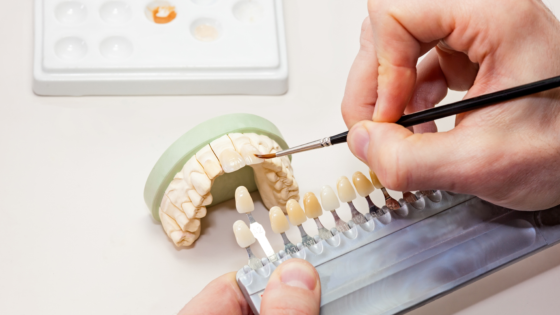 A dentist choosing the right colour of dental crown