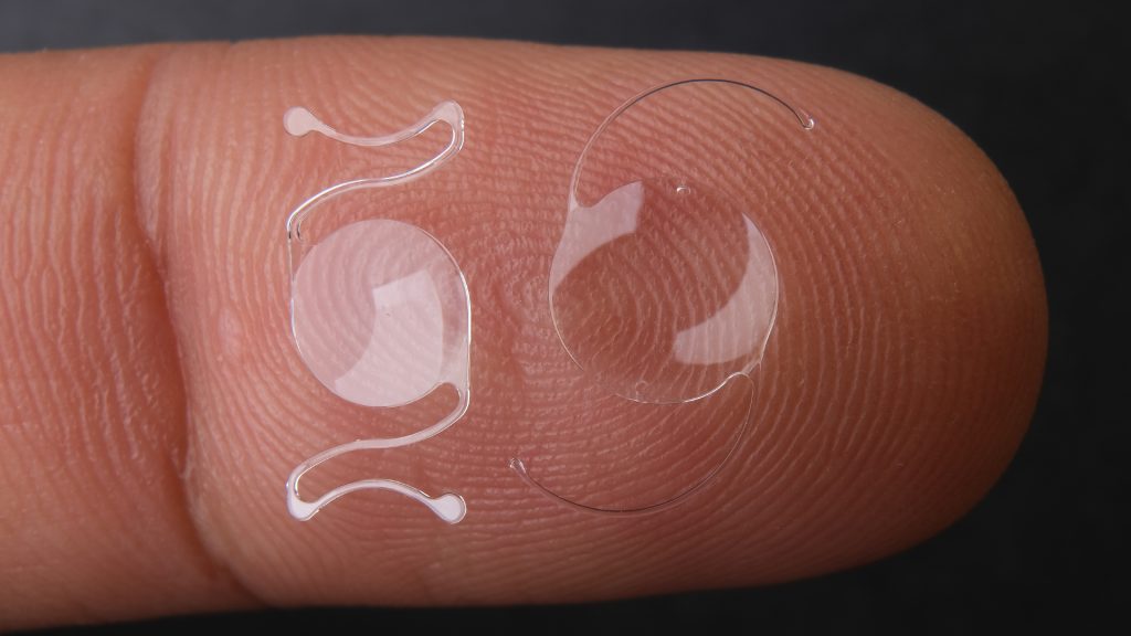 Multifocal Lens (intraocular lenses): pros and cons, prices and success ...