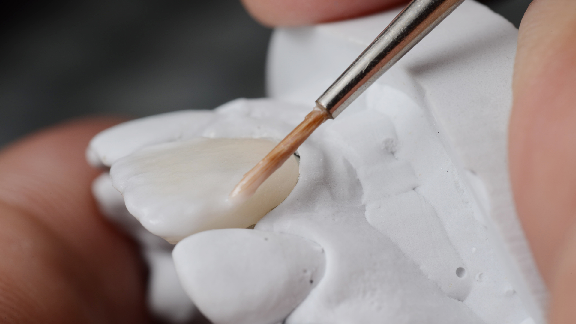 Un prothésiste dentaire réalisant une finition Emax sur une facette dentaire en céramique