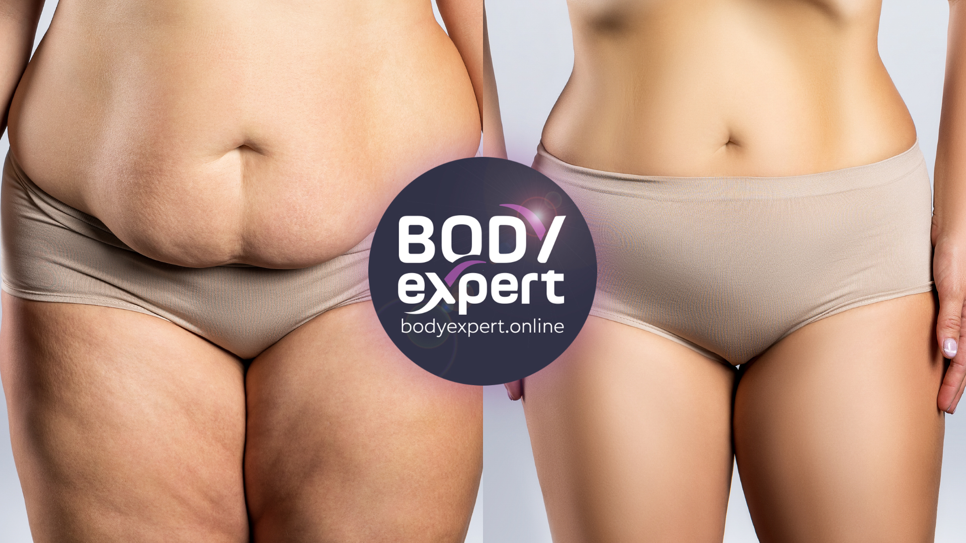 Belly and thick liposuction : before and after