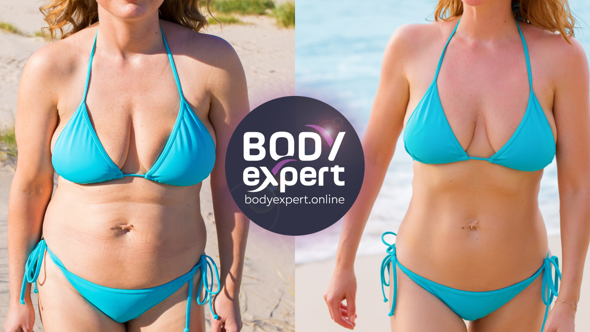 Stomach liposuction, the results before and after the surgery