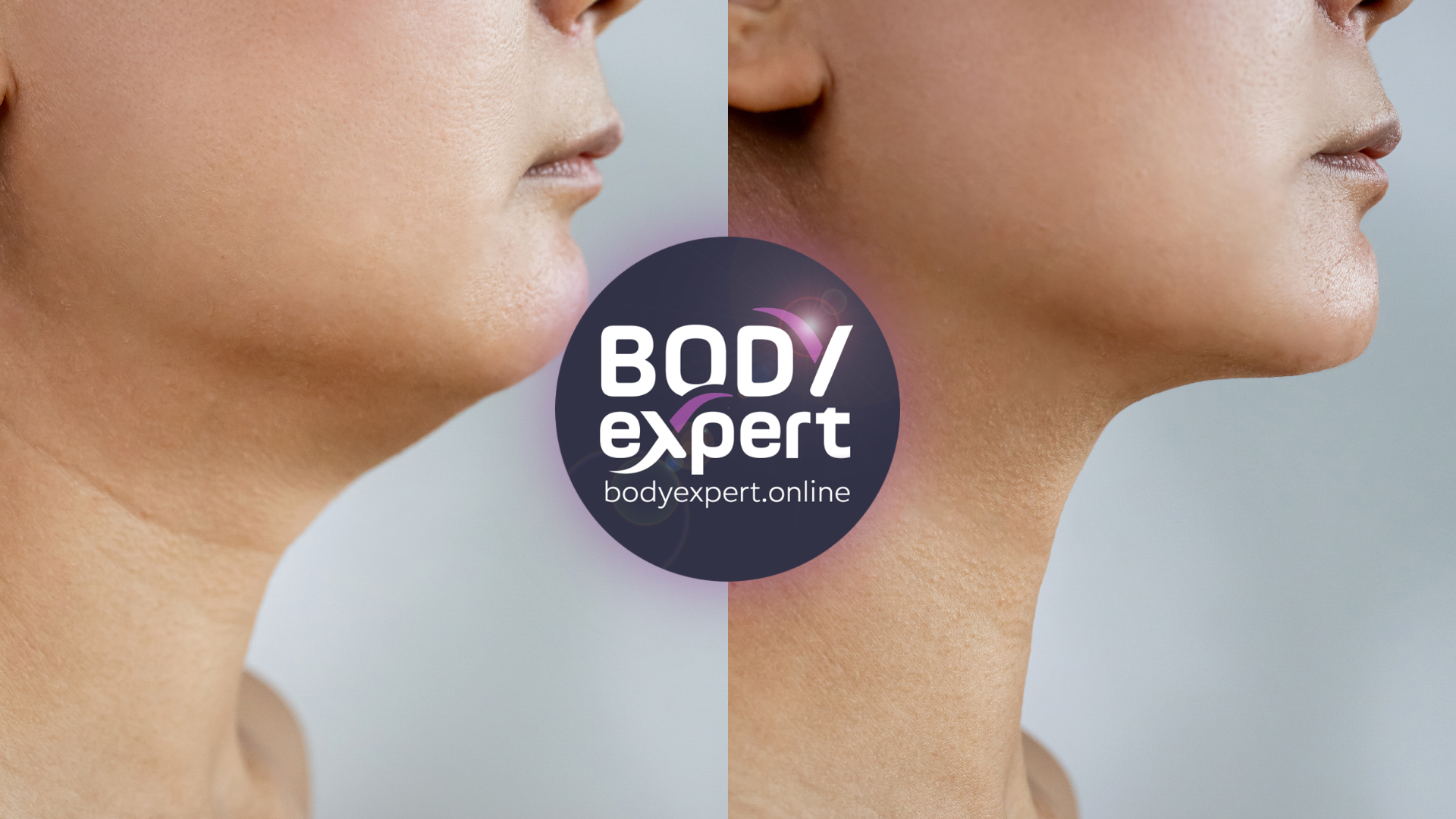 before and after a neck liposuction
