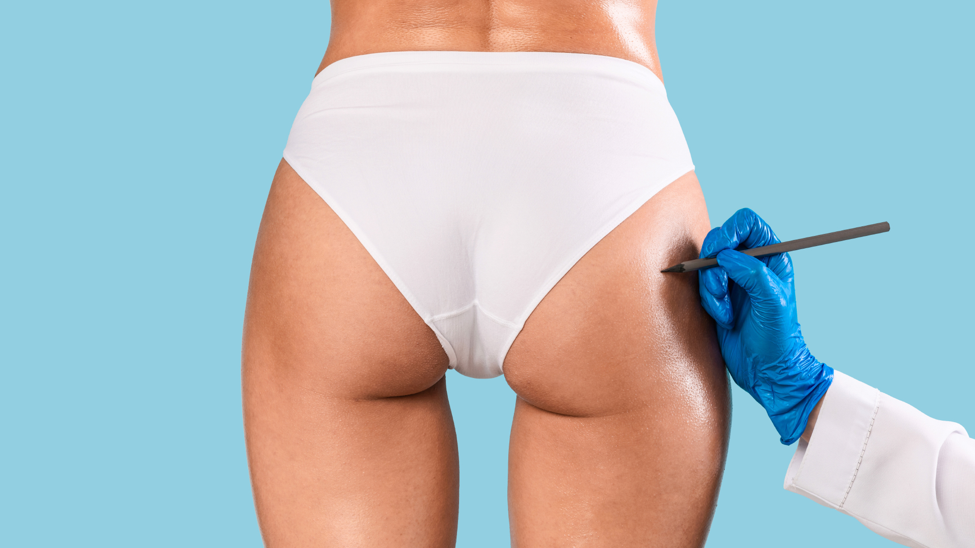 a surgeon marks the fatty areas to be eliminated before hip liposuction