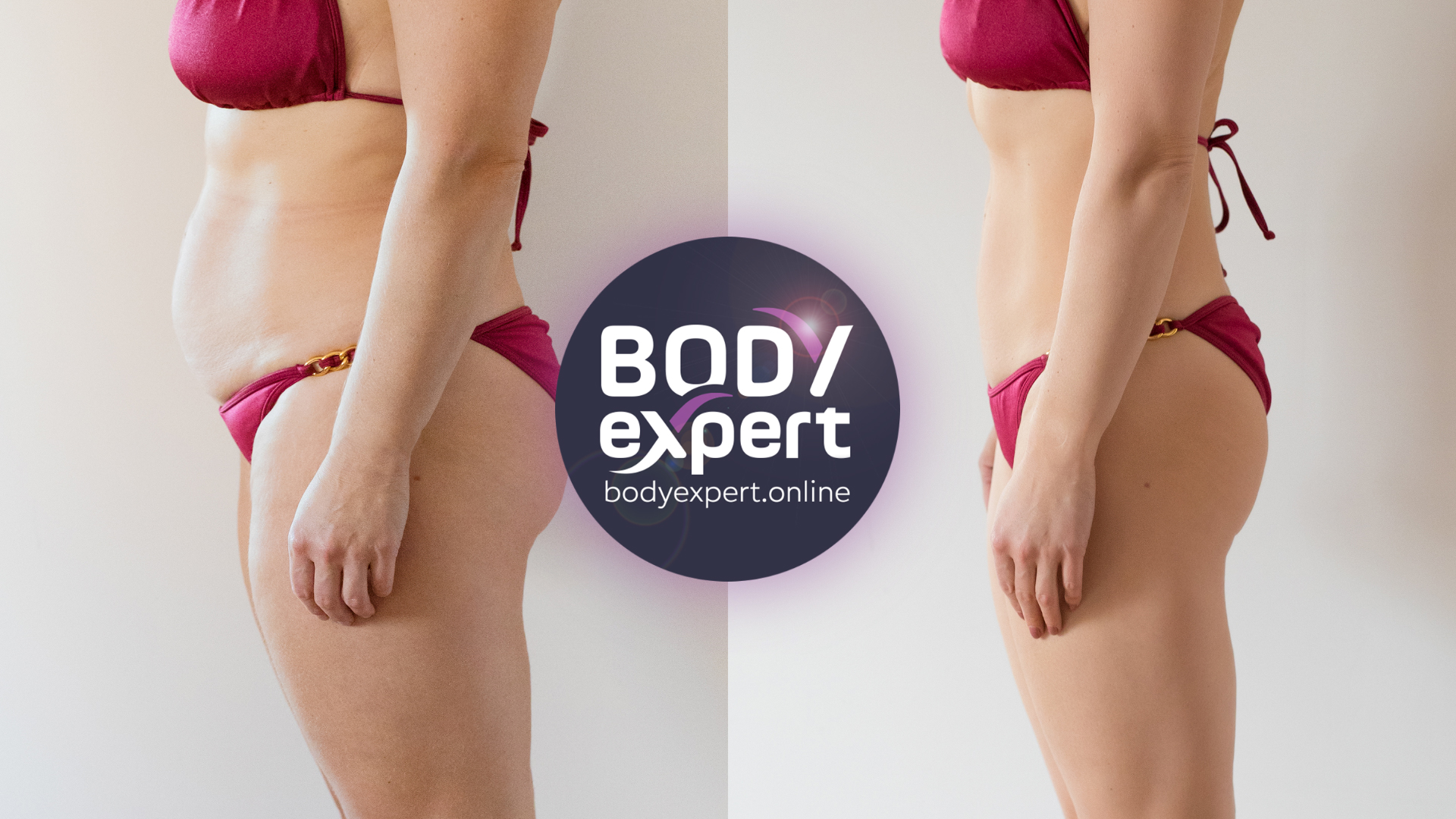hip liposuction in Turkey, before - after