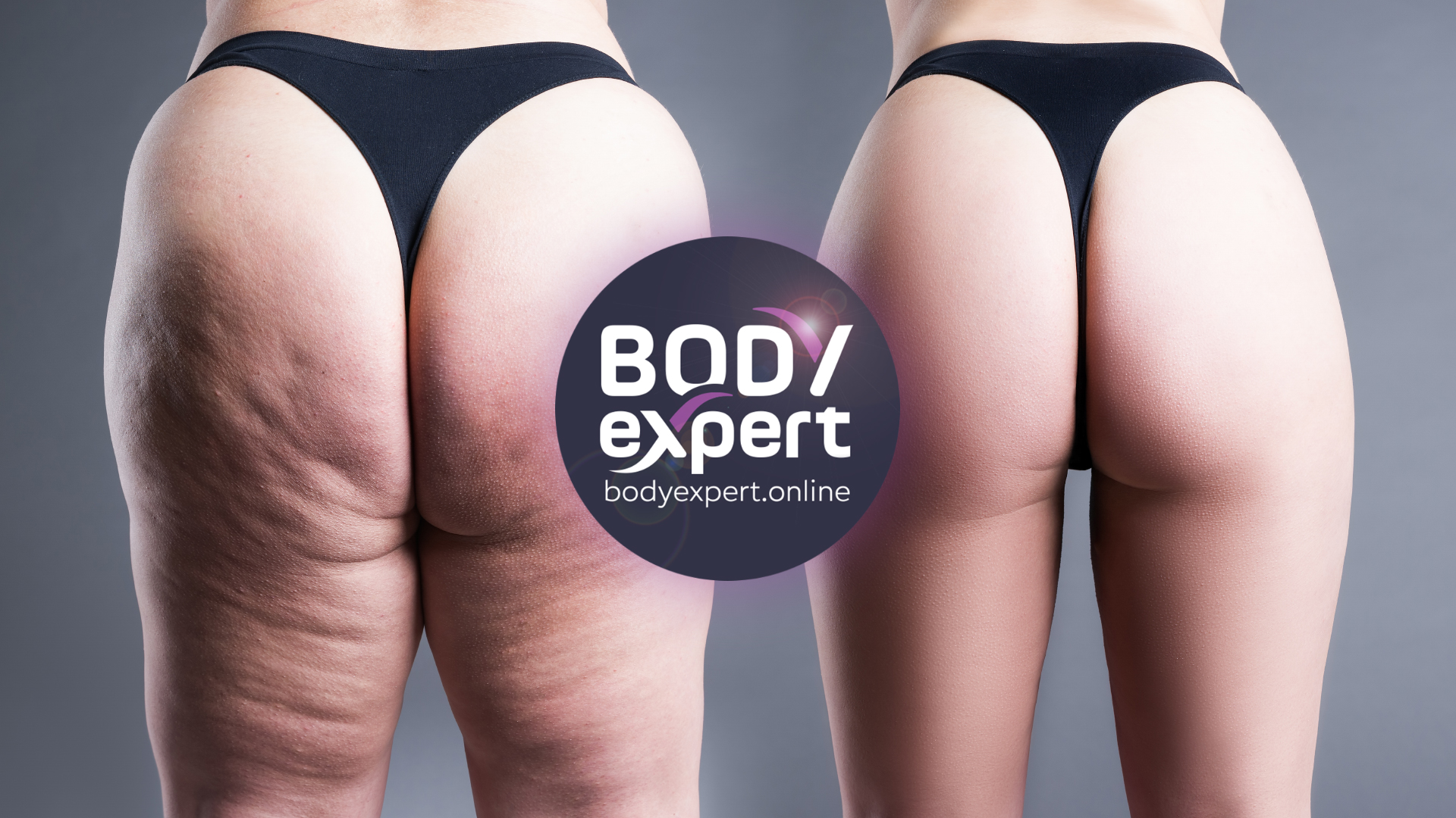 results before and after hip liposuction