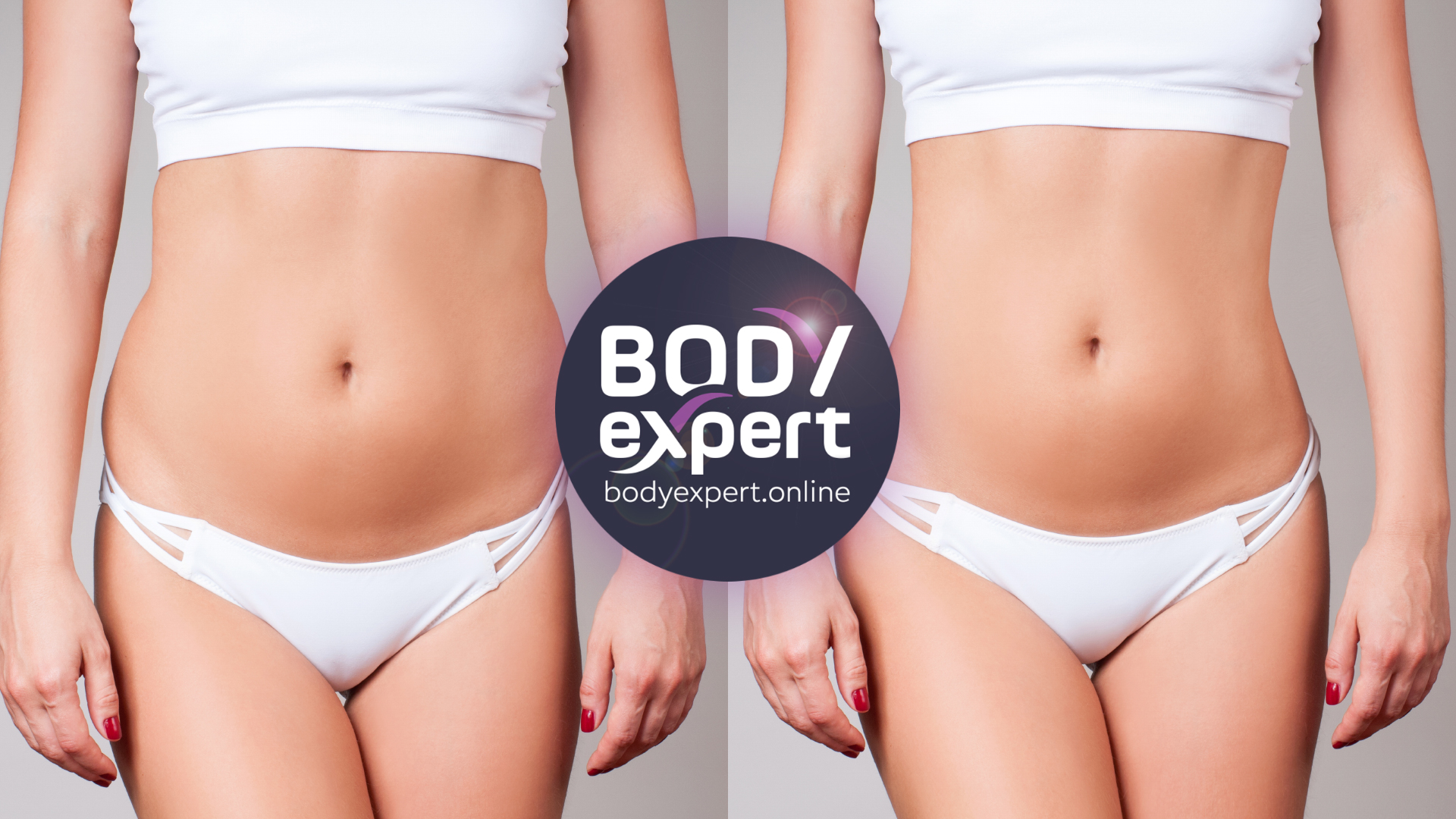 the results, before and after a love handle liposuction