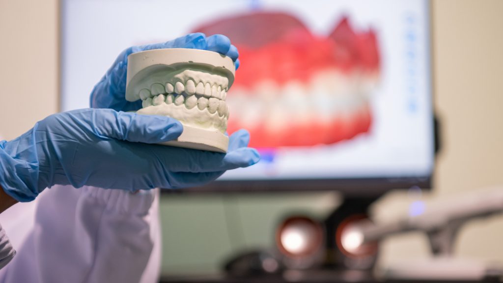 Malocclusion : treatments, types and consequences