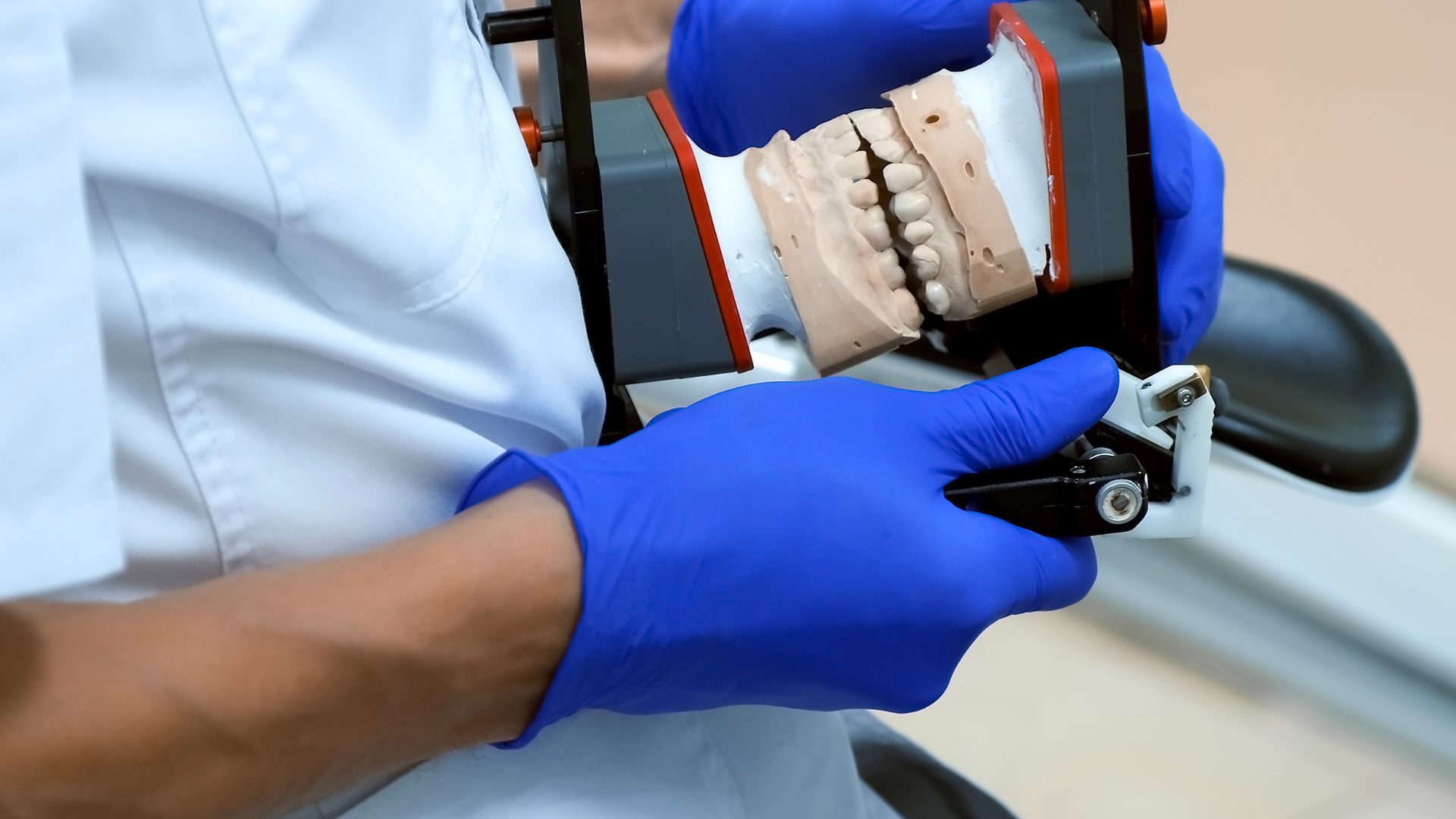A denture having a malocclusion molded