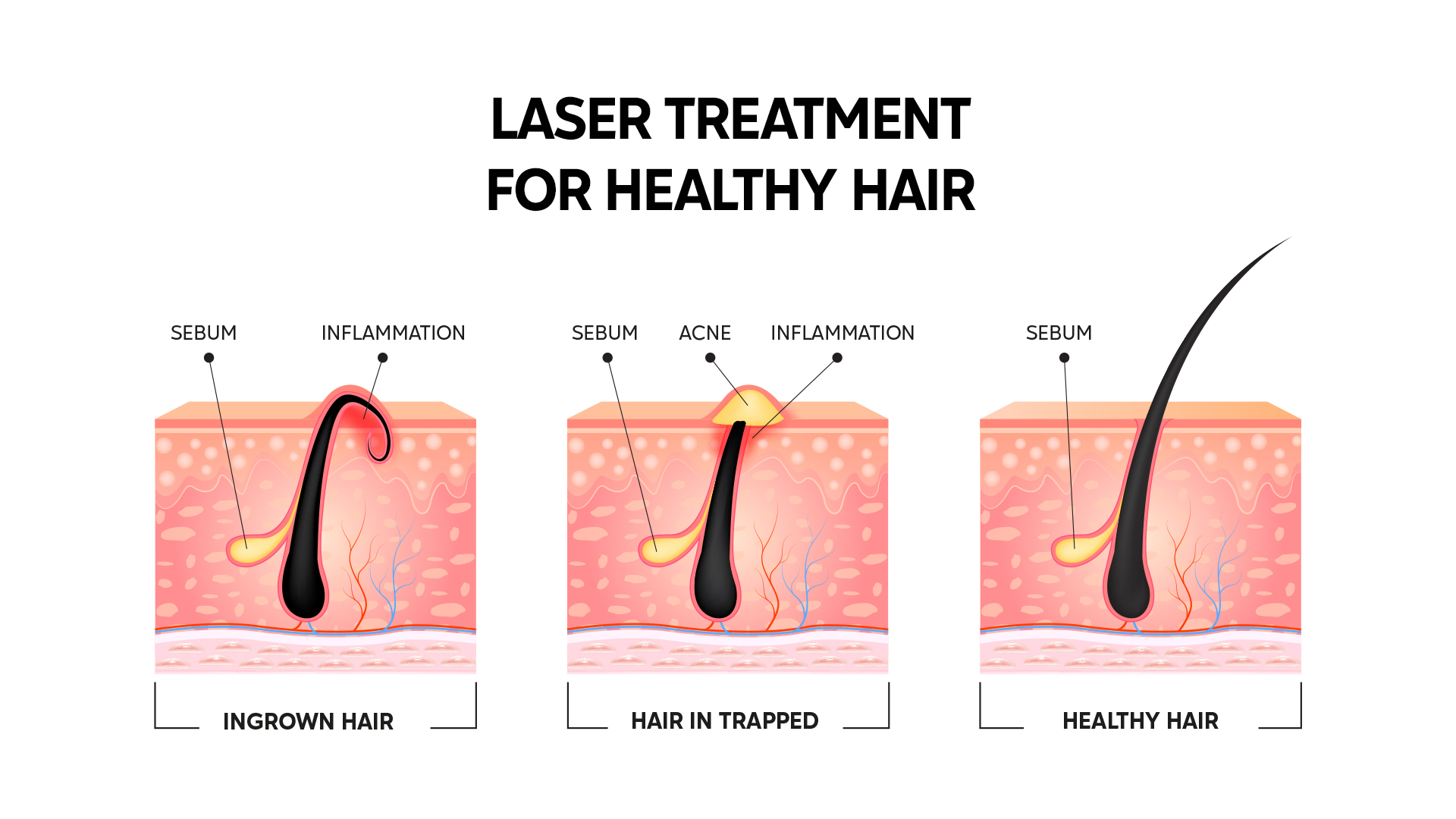 How laser treatment helps