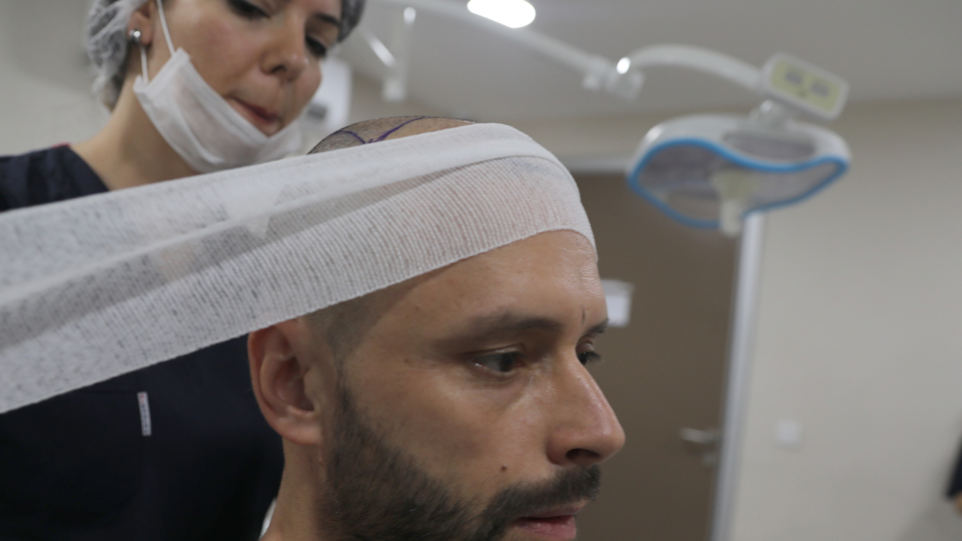 Failed hair transplant: how to avoid it and how to correct it?