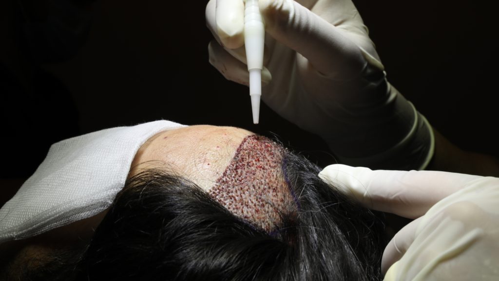 cheveux-sans-racage-01