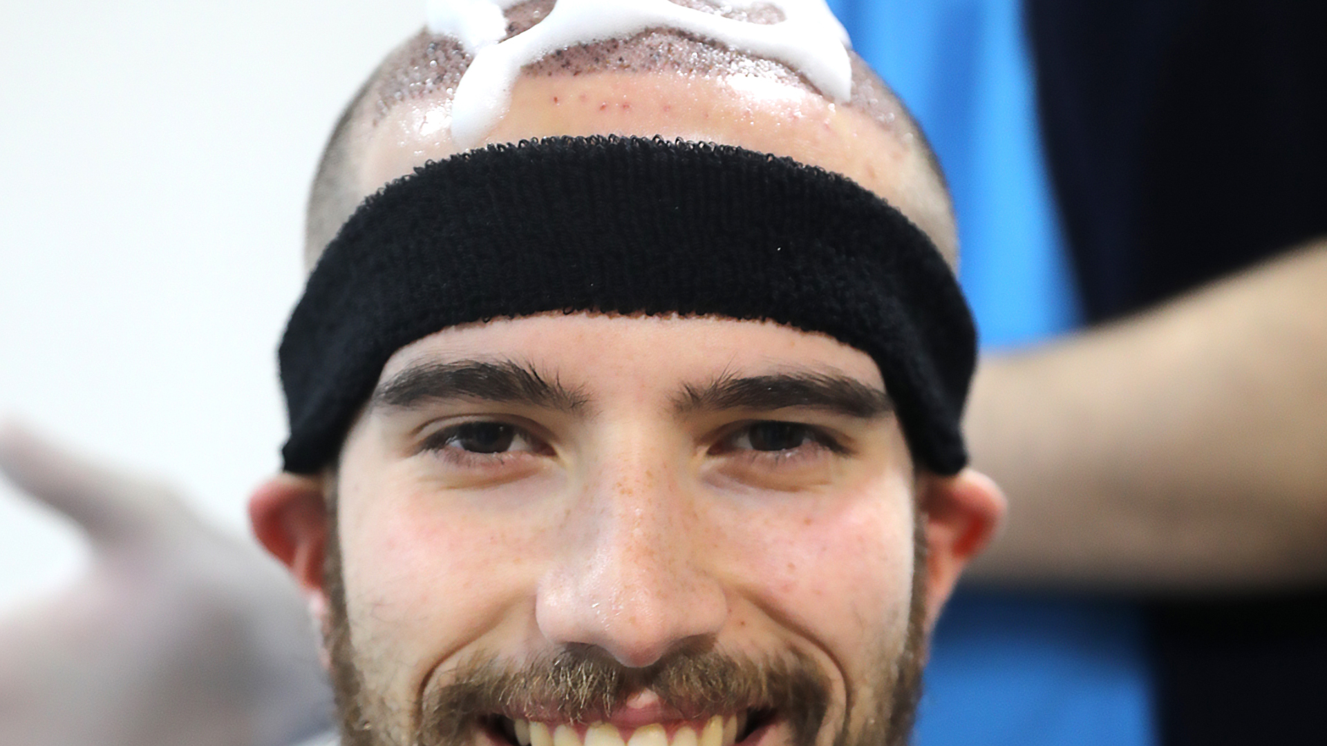 a person undergoing their first shampoo after a hair transplant