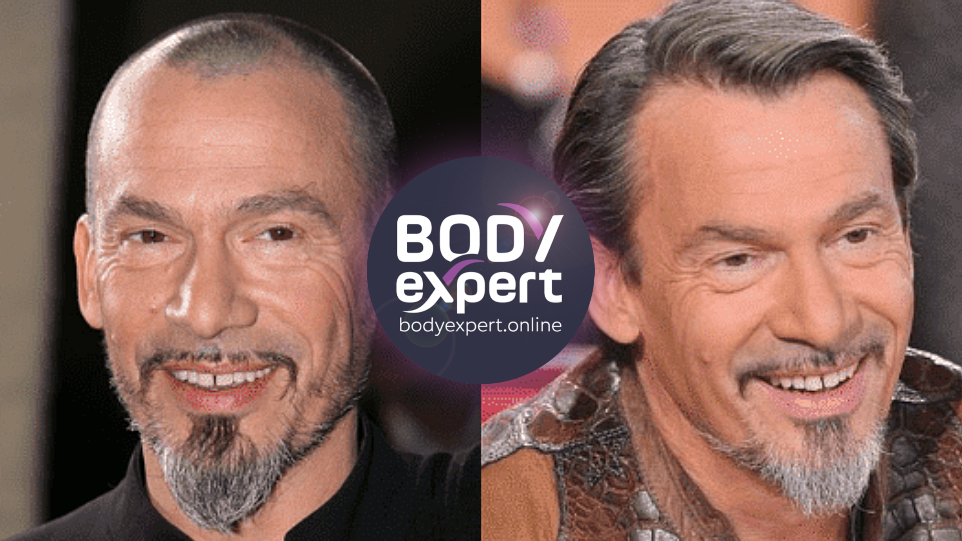 Florent Pagny avant et après sa greffe de cheveux