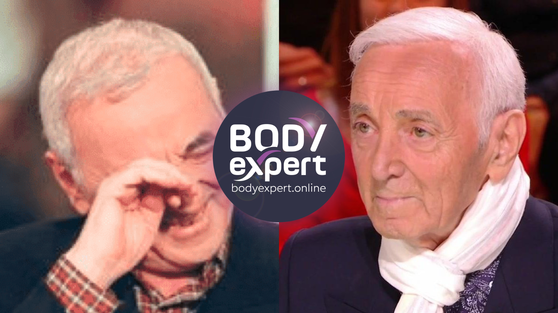 Charles Aznavour avant et après sa greffe de cheveux