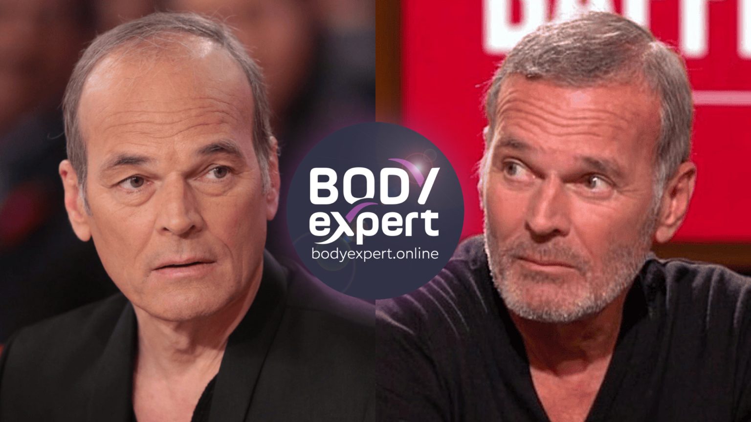 Greffe de cheveux : quelle star a des implants capillaires