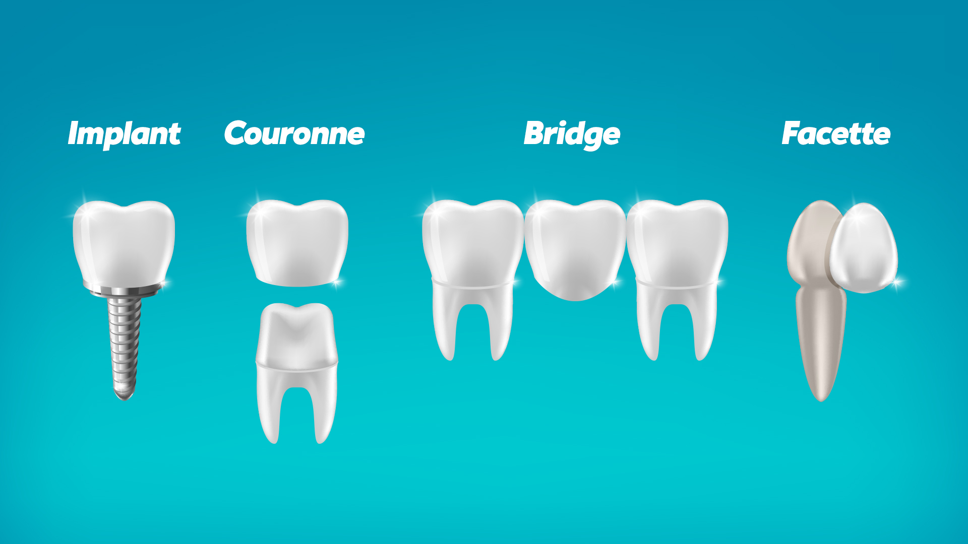 Couronne provisoire – types, matériaux, durée et prix