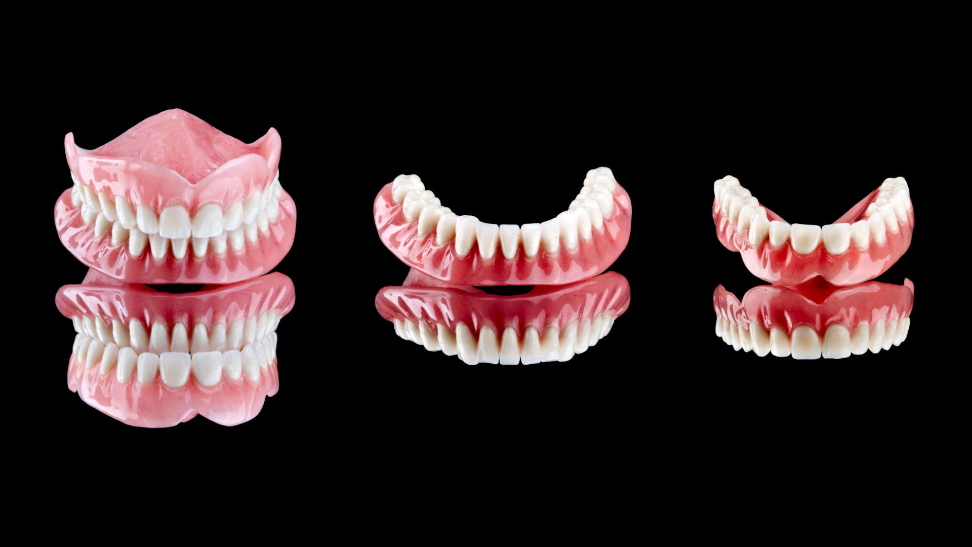 différents modèles de prothèses dentaires fixes