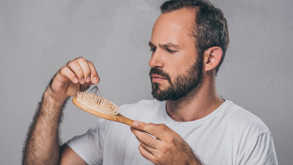 Androgenetic alopecia: all about this cause of baldness Androgenetic alopecia: all about this cause of baldness