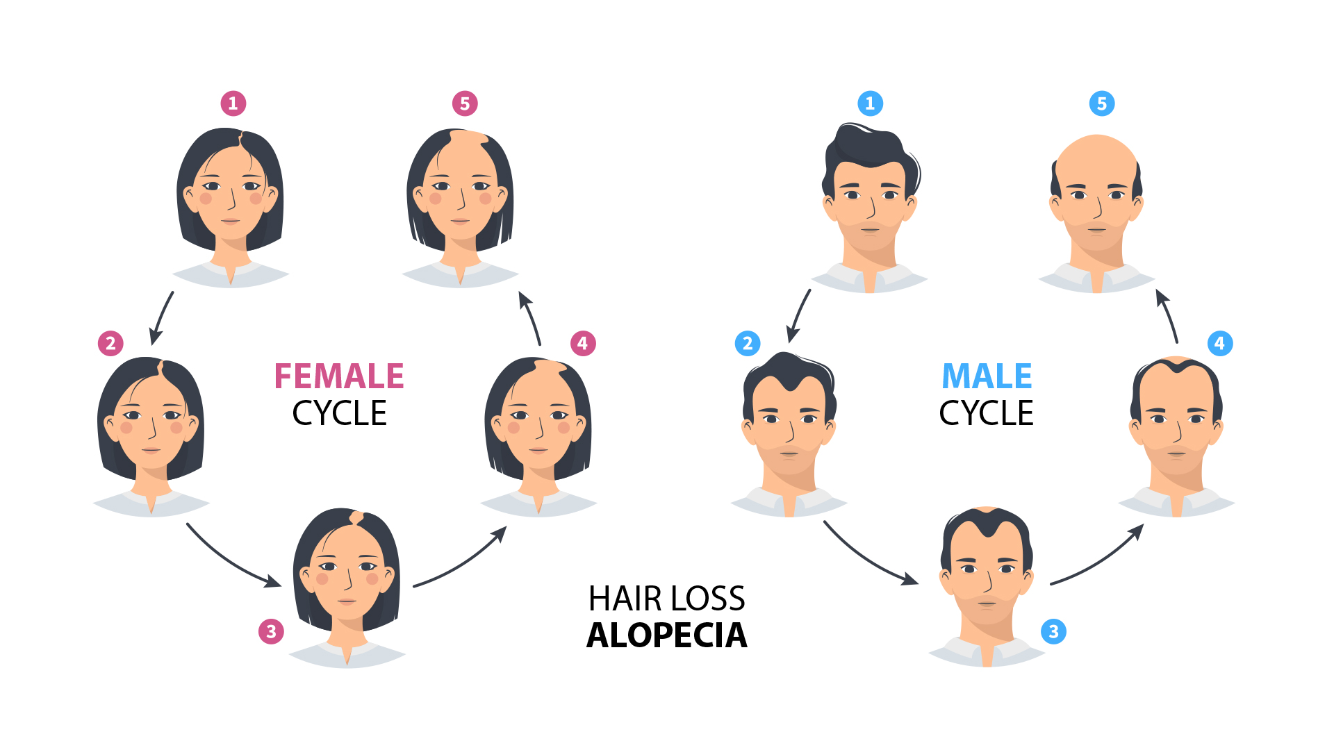the scale of Androgenetic Alopecia in men and women