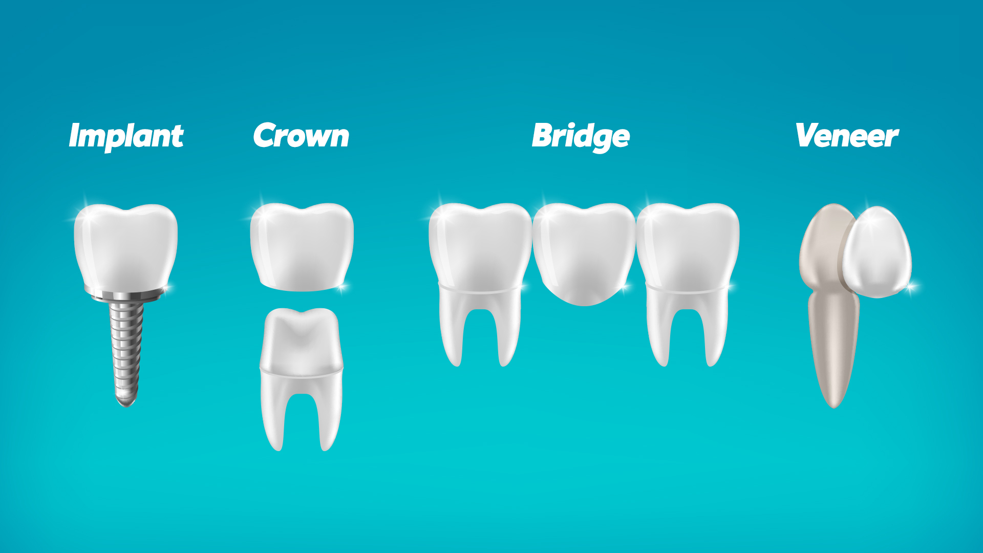 Dental prosthesis types