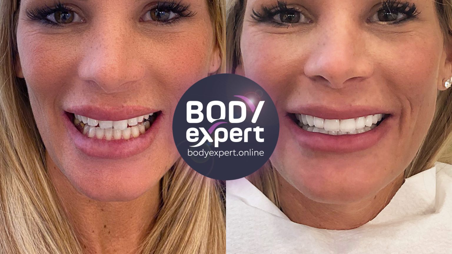 Refaire Ses dents Les solutions possibles et leurs prix. — free download