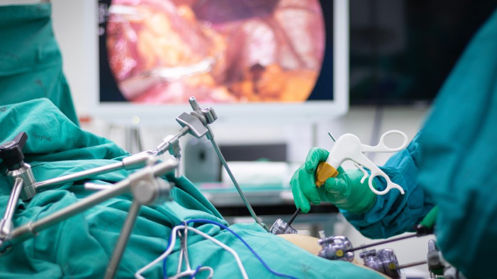 Sleeve vs Bypass quelle intervention choisir