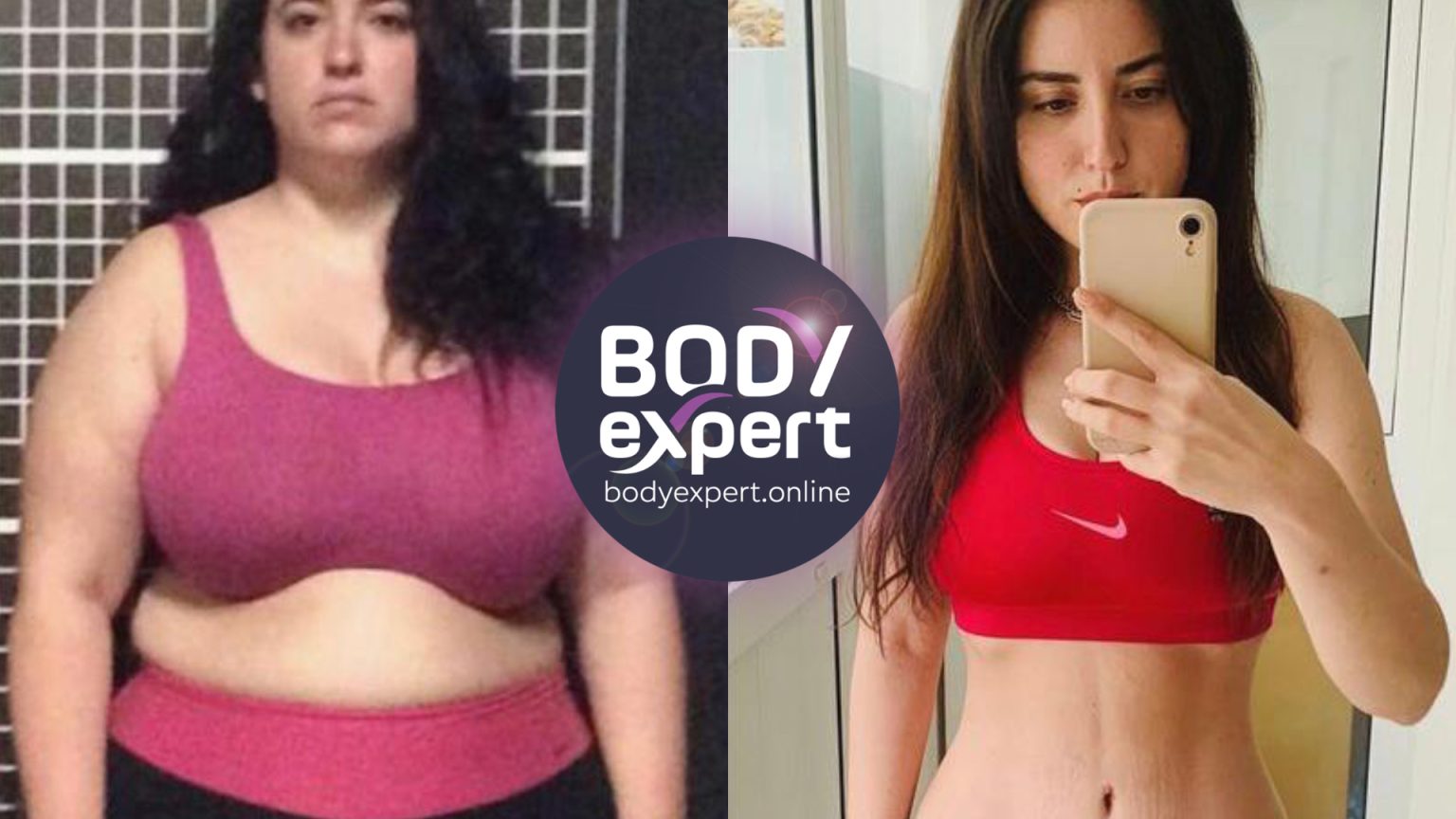 Sleeve vs Bypass quelle intervention choisir