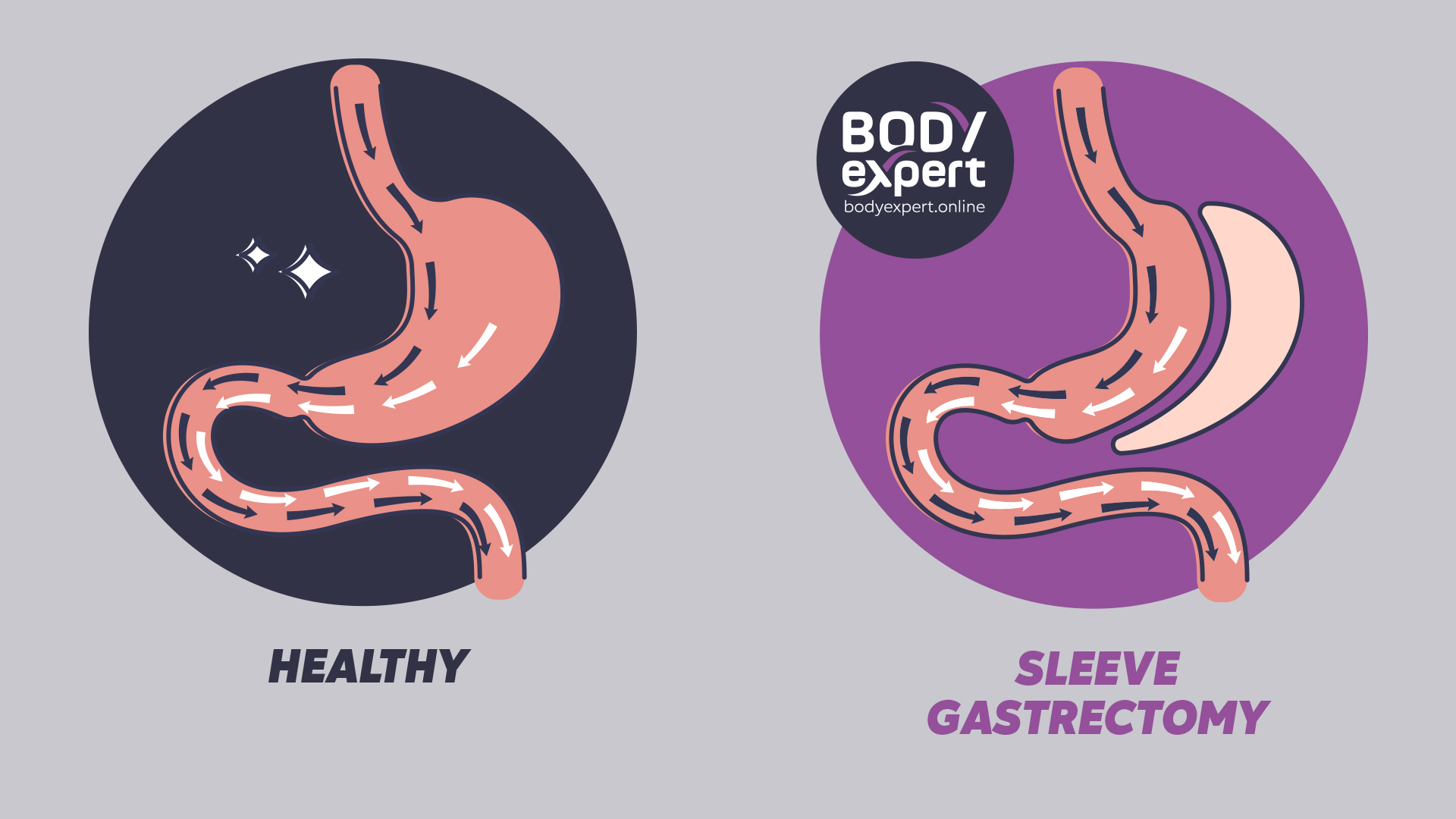 Expert Meal Planning for Bariatric Patients - Healthier Weight