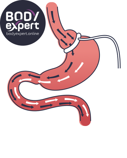 03 FR Dessins pages filles_Anneau gastrique FR-02