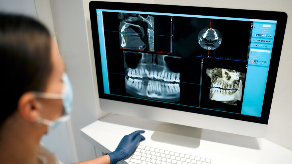 01-BE-IMPLANT-A--LETRANGER